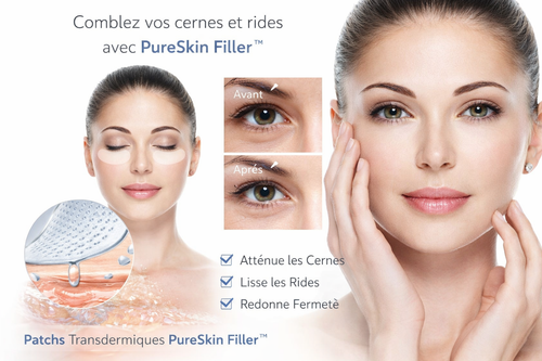 PureSkin Filler™ — Patchs Micro-Cristallins à l'Acide Hyaluronique